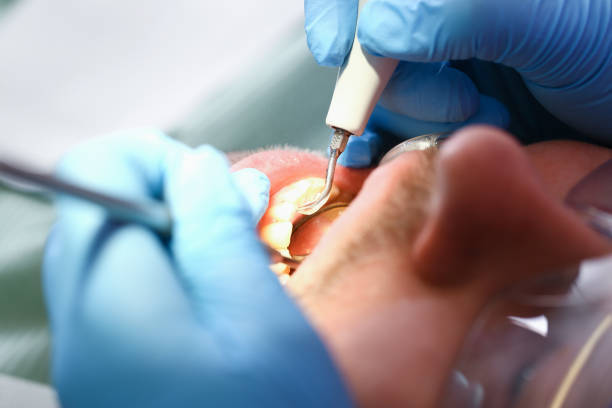Best Emergency Dental Filling Replacement  in Reinholds, PA