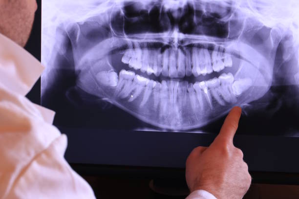 Best Broken Tooth Emergency  in Reinholds, PA